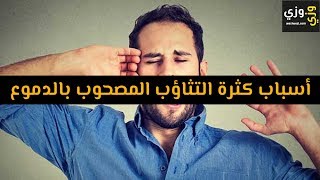 أهم أسباب كثرة التثاؤب المصحوب بالدموع