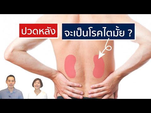 ปวดหลัง จะเป็นโรคไตได้มั้ย | EasyDoc Family Talk EP.19