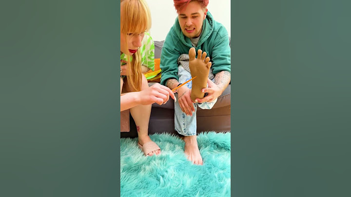 الوخز بالإبر المزيف في القدم #مقلب