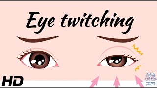 The Science Behind Eyelid Twitching: Explained