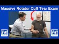 Massive rotator cuff tear with indication for reverse total shoulder replacement