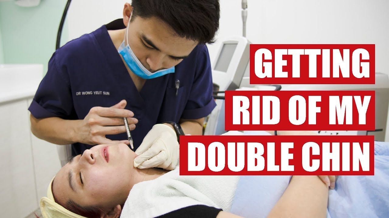 Getting Rid of my Double Chin | Kybella - YouTube