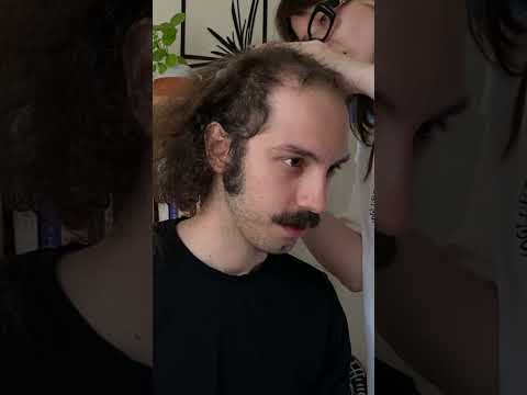 Balding Man WOWED