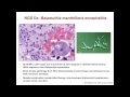 Charles Chiu - Next Generation Sequencing for Diagnosis and Surveillance of Emerging Infections