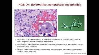 Charles Chiu - Next Generation Sequencing for Diagnosis and Surveillance of Emerging Infections