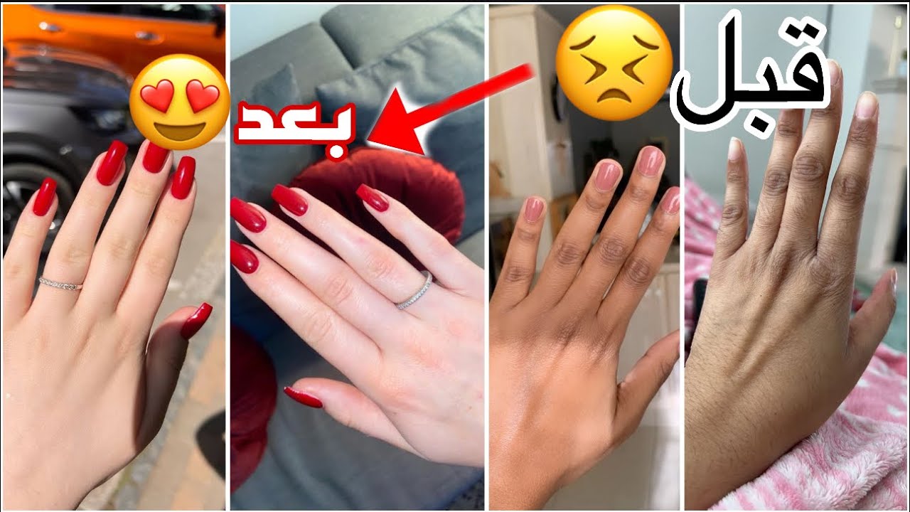 تبييض اليدين 5 درجات من اول استعمال| تفتيح عقل الاصابع ايدي في غايه النعومه بدون جفاف او تجاعيد