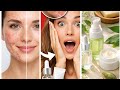 Blackheads vs Cystic Acne: Which Treatment Actually Works?