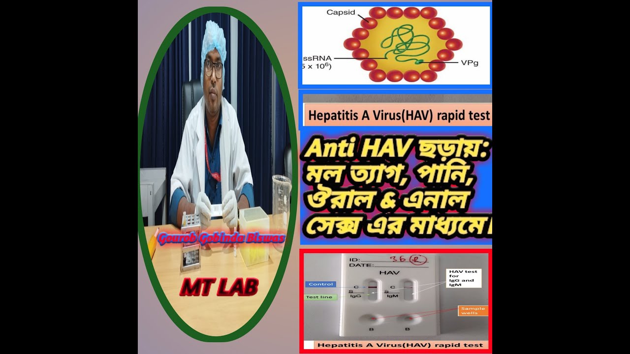 Hepatitis A Virus (HAV) IgM & IgG Device Method Procedure. Hepatitis  A test in Bangla.