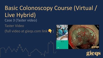 Case 3 (Taster video)