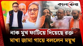 নাক মুখ ফা'টিয়ে দিয়েছে, র'ক্ত মাখা জামা গায়ে বললেন ময়ূখ  | Mayukh Ranjan Ghosh | Kalbela
