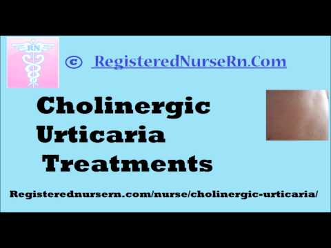 Cholinergic Urticaria Treatment