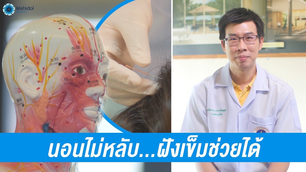 การฝังเข็มบำบัดอาการนอนไม่หลับ | พบหมอมหิดล [by Mahidol Channel]