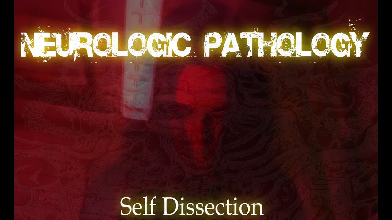 Neurologic Pathology - Self Dissection ( Brutal Death Metal From Ukraine ) ( Demo )