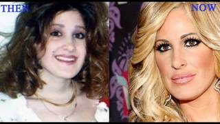 Kim Zolciak Plastic Surgery Before and After