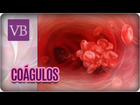 Vídeo: Diferença Entre Coágulo De Sangue E Tecido