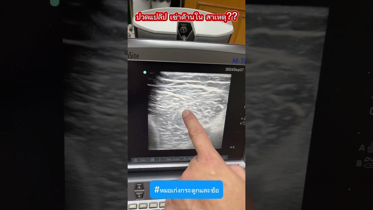 ปวดแปล๊บๆเข่าด้านใน สาเหตุ? #หมอเก่งกระดูกและข้อ #ปวดเข่า #เอ็นอักเสบ #ข้อเสื่อม #ข้ออักเสบ