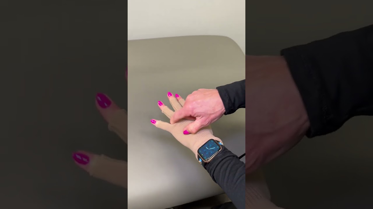 Our compression gloves are here to help manage your lymphedema! 🧤