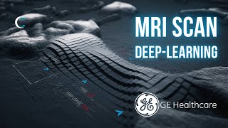 MRI with AIR™ Recon DL by GE -  2022 The future is here (3D medical animation)