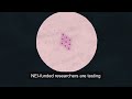 A Cutting-Edge Treatment for Cornea Damage (audio-described version)