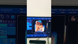 Download Lagu Wajah ganteng Sudah kelihatan.... #baby #murotalibuhamil MP3