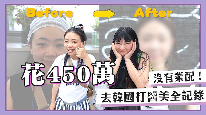 【嘎嫂二伯Vlog#50】沒有業配！花450萬去韓國打醫美全記錄！