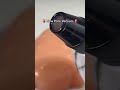 Pimple &amp; Blackhead Removal Tutorial