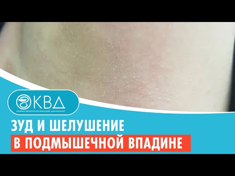 😕 Зуд и