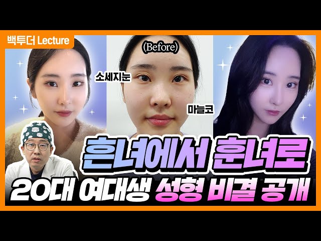 [눈재수술] 두 달 만에 ✨여돌 비주얼✨ 완성! 비결은❓