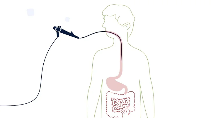 What is an Esophagogastroduodenoscopy (EGD)