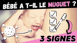 Comment Savoir Si Bebe A Du Muguet Symptomes Muguet Bebe Youtube