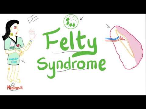 Felty Syndrome | The infamous Triad | Rheumatology