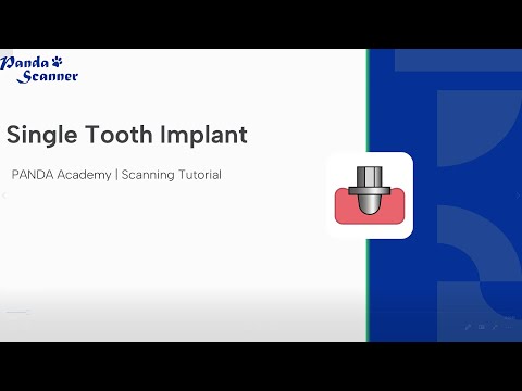 Implant-Single tooth Scanning method of the scan body