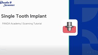 Implant-Single tooth Scanning method of the scan body