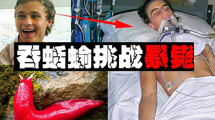 [Parasitic Tumor] The boy swallowed the slug and became paralyzed for 420 days. He died 8 years lat - 天天要聞