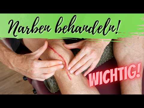 Scar stuck, hardened, or sensitive? 5 self-treatment techniques