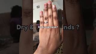 Fair Hand Tips | Hand Whitening Tricks | Easy Manicure | Remove Suntan #manicure #ytshorts #shorts