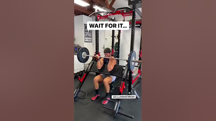 Bilateral Distal Biceps Tendon Rupture (RARE) #shorts