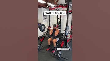 Bilateral Distal Biceps Tendon Rupture (RARE) #shorts