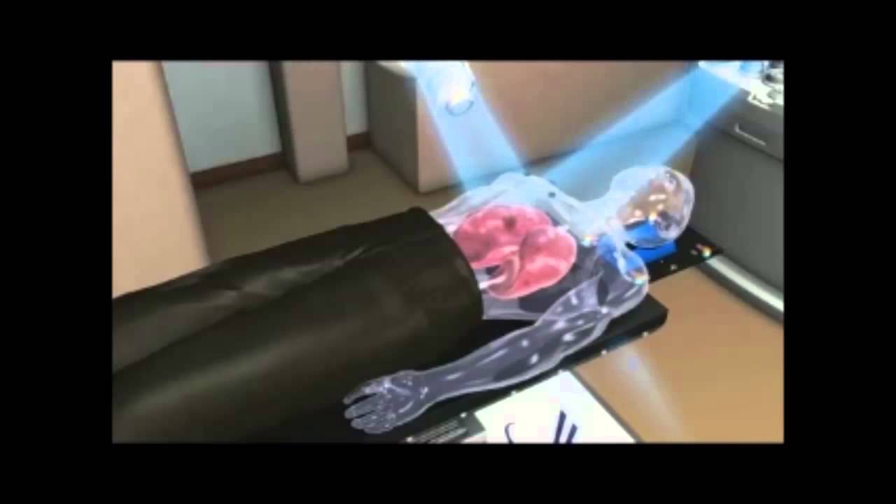 MY025 - Respiratory Motion Tracking using the Kinect Camera on an Embedded System