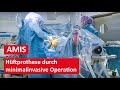 Hftprothese durch minimalinvasive amis methode  live operation