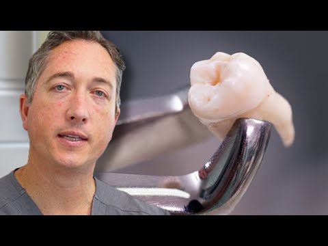 When Is a Tooth Extraction Necessary? | Doctor Explains