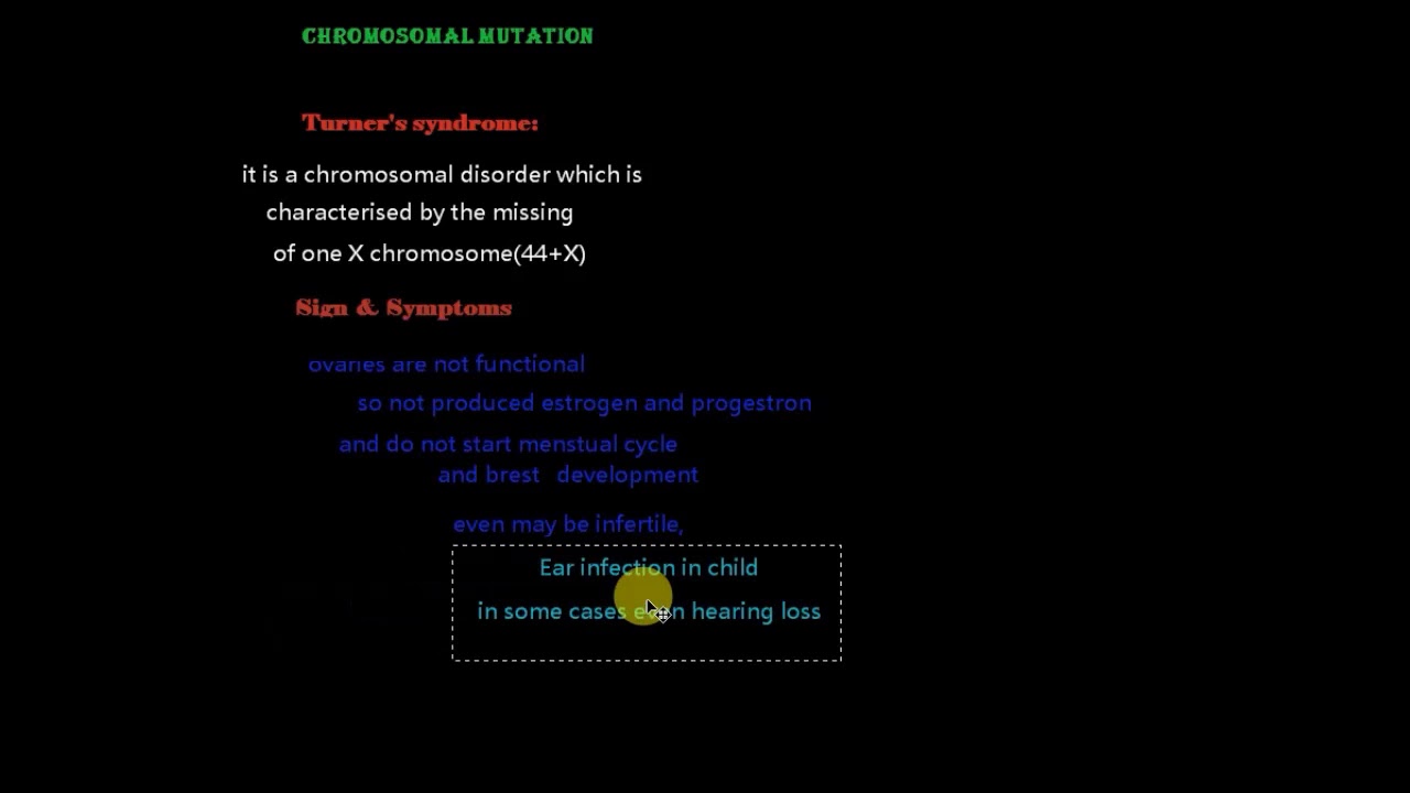 Turner syndrome YouTube