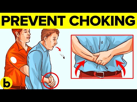 How To Perform The Heimlich Maneuver When Someone Is Choking