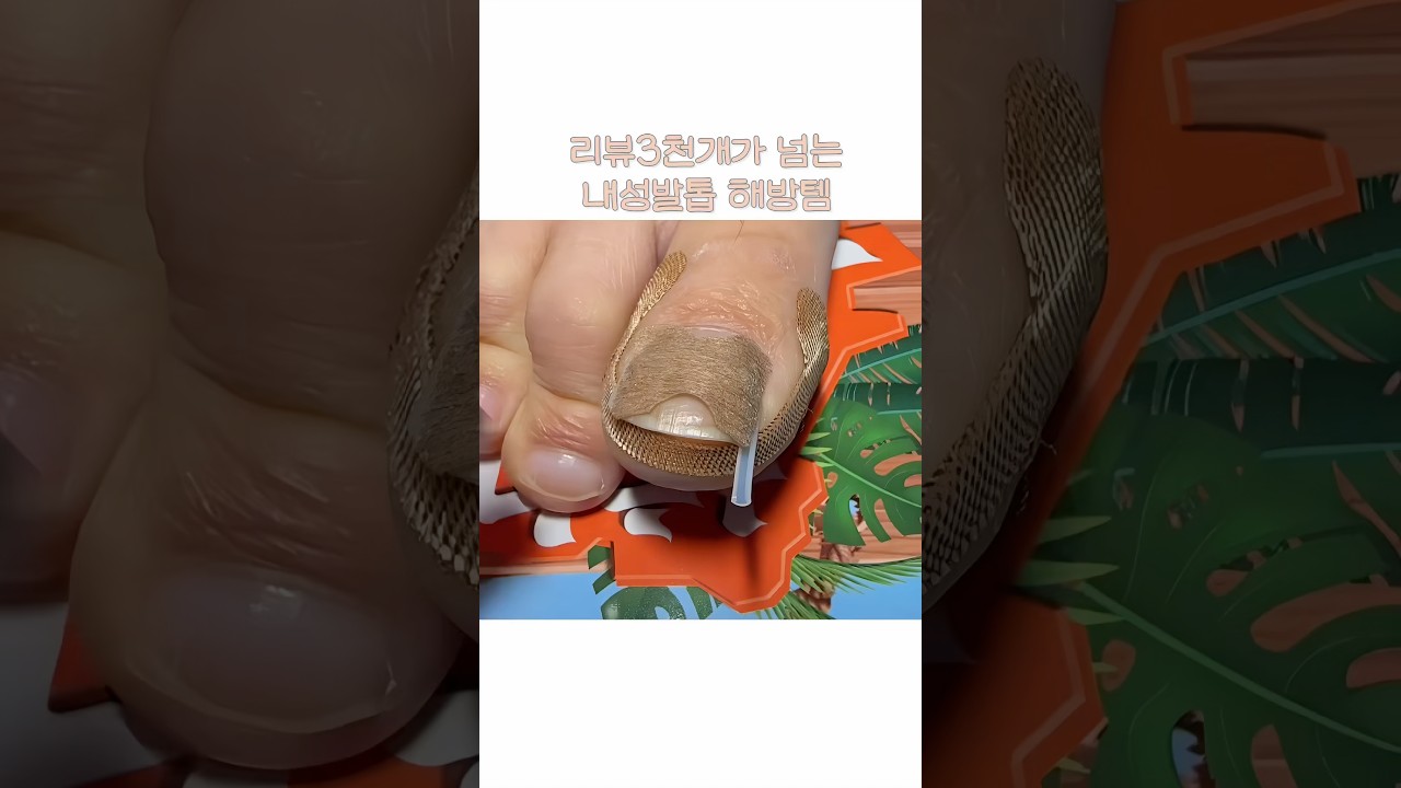 내성 발톱 집에서 관리할 수 있는 방법
#발톱 #내성발톱관리