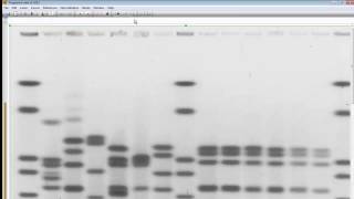 Import And Analyze Your Second Gel Bionumerics 7