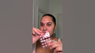 Pimple Patches #pimple #pimplefreeskin #blemishes #beautytips #skincareroutine #pimplepatch #patch