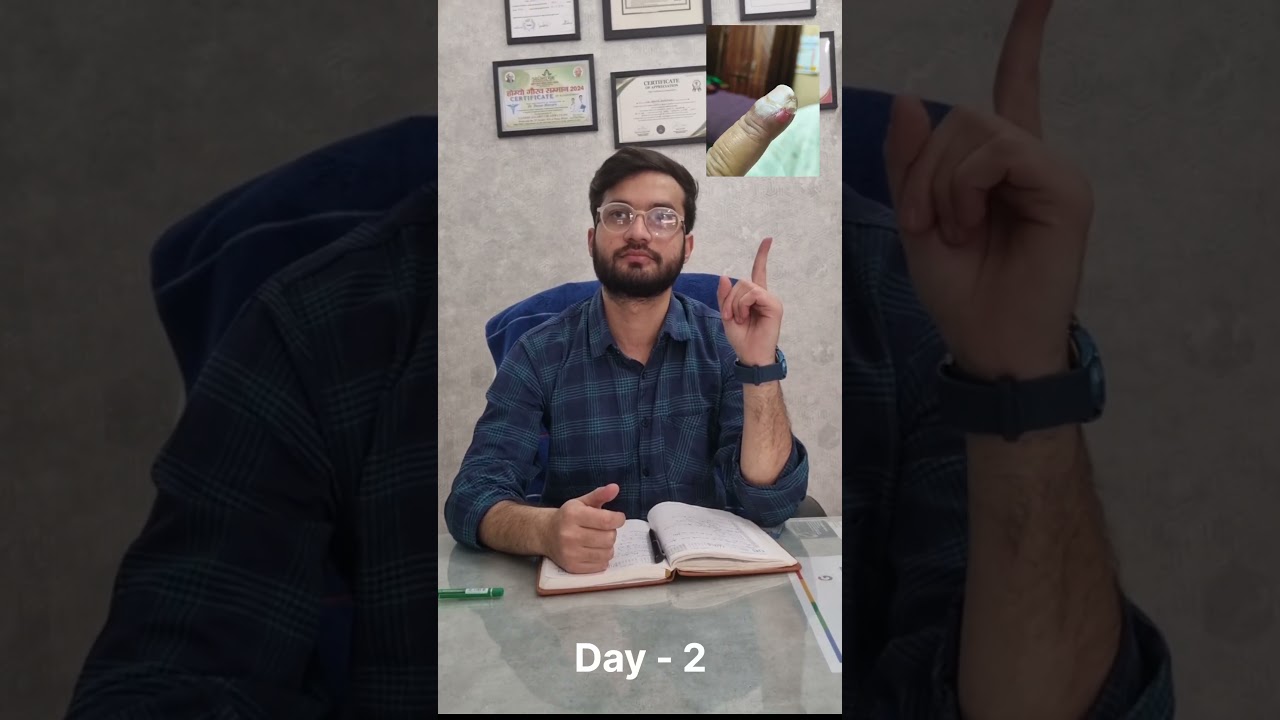 choose Homeopathic treatment for permanent cure 💐 