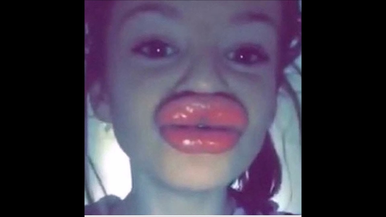 Kylie Jenner Lips Fail Famous Person