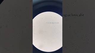 Rotina Laboratorial Paracoccidioides Spp.