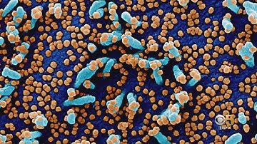 COVID: Scientists In A Race To Learn More About Omicron Variant